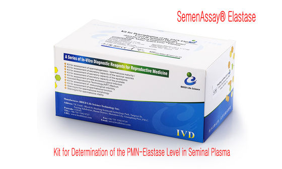 Экономический набор теста фрагментации ДНК спермы для определения уровня фрагментации ДНК--метод рассеивания хроматина спермы