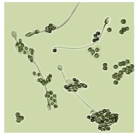 Набор для определения сперматозоидов антитела IgA покрывая (ПОВРЕДИТЕ)