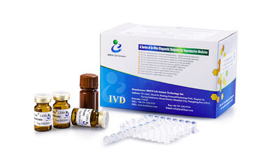 Быстрый набор теста мужской плодовитости диагноза для уровня ЛДХ-С/ЛДХ-К4 спермы определения